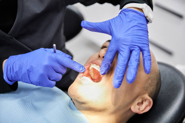 Best Emergency Dental Services for Seniors in Canton, SD